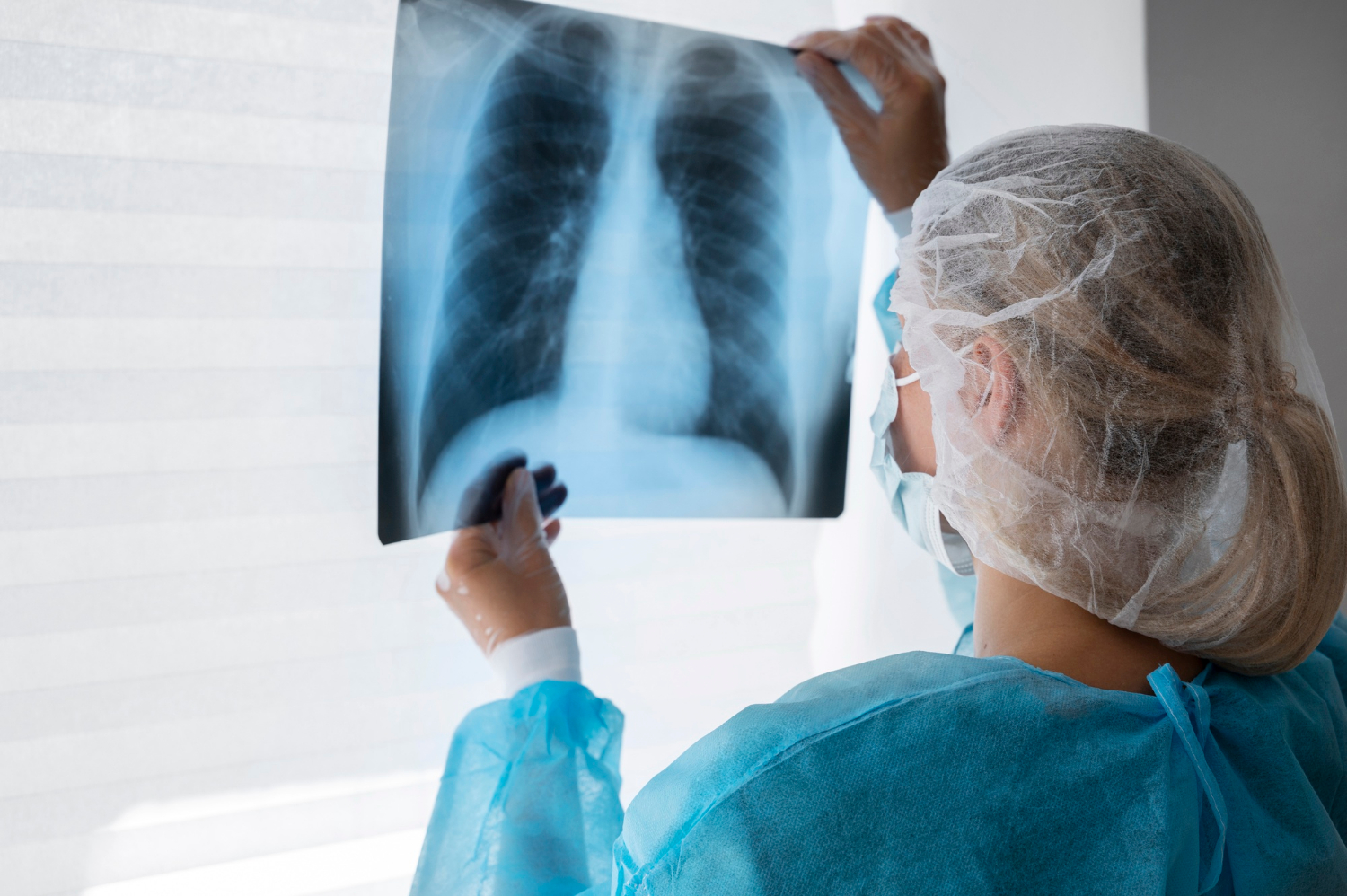 Onkolog: mamy kolejne przełomowe terapie dla chorych na raka płuca