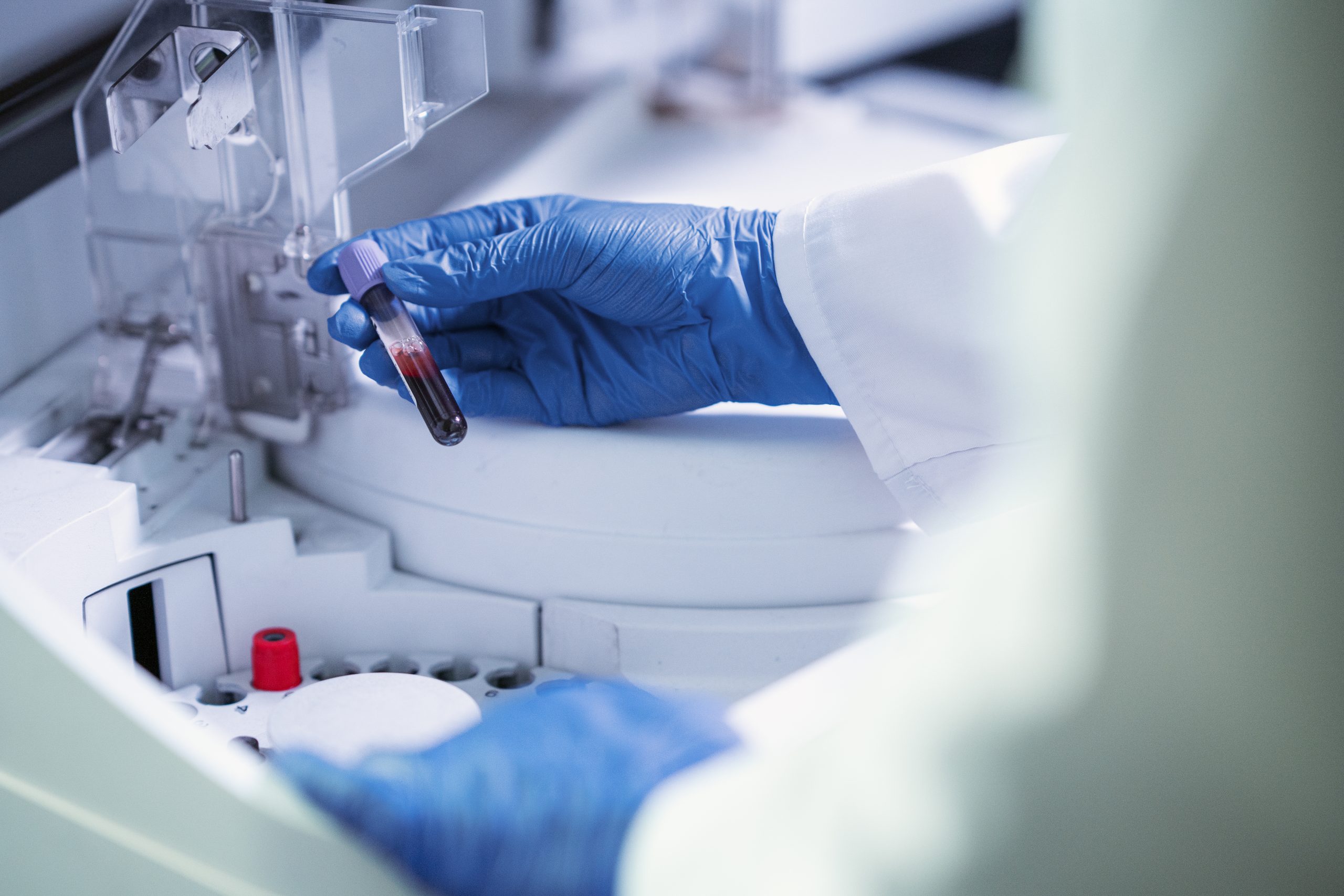 Diagnostyka onkologiczna nadal kuleje. Eksperci alarmują: „Rozwiązania potrzebne na wczoraj”